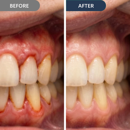 Cougex™ Precision Gum Care Gel – Daily Support for Sensitive, Tender & Bleeding Gums